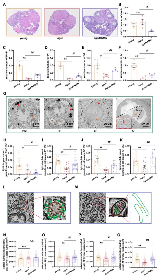 representative pictures of HE staining in frozen sections of ovary of different groups of mice