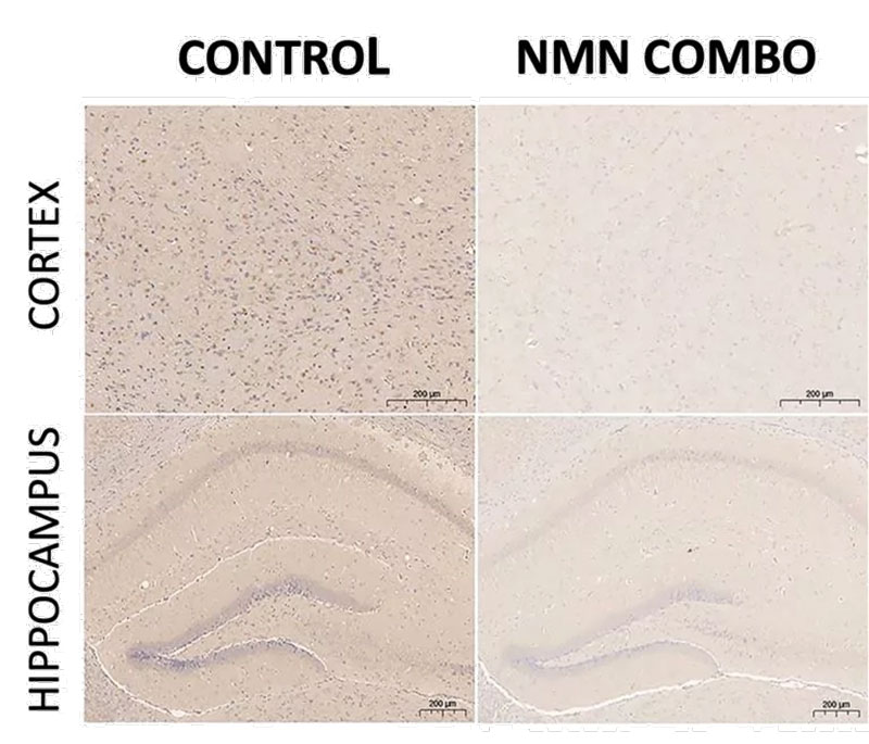 The combination of NMN, L. plantaurum and lactulose reduces Alzheimer's disease plaques. Patches are indicated by purple spots. The NMN combination had fewer purple spots than the control group, indicating fewer Aβ plaques.