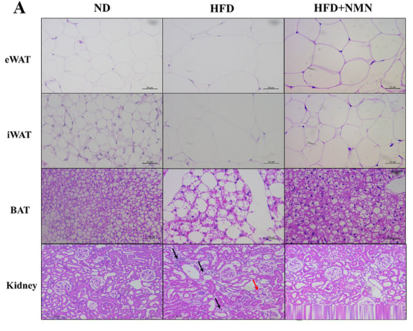 Long-term administration of NMN improved the pathological changes of peripheral tissue in HFD-treated mice. In HFD + NMN group, the cross-sectional area of adipocytes was significantly reduced, the cells were more closely arranged, and the pathological changes of kidney tissues were also significantly reduced, which directly showed the improvement effect of NMN on tissue morphology.